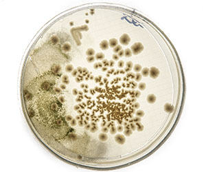 чашка петри_0001_VA__1841