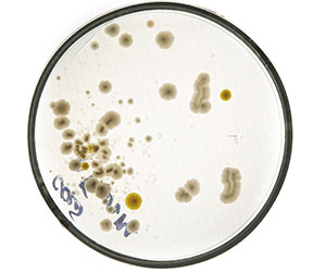 чашка петри_0003_VA__1836