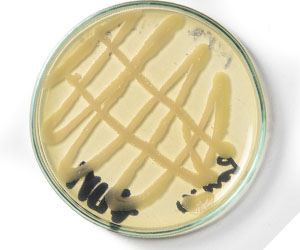 чашка петри_0005_VA__1816