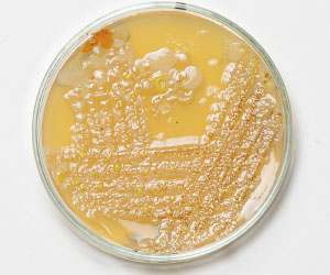 чашка петри_0012_VA__1790